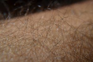 in cat timp creste parul dupa chimioterapie